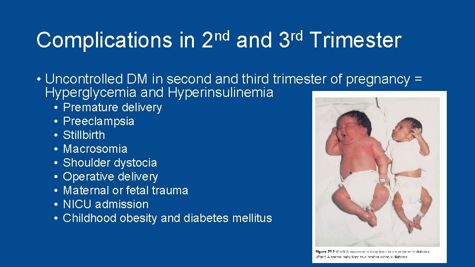 Complications in 2 nd and 3 rd Trimester • Uncontrolled DM in second and
