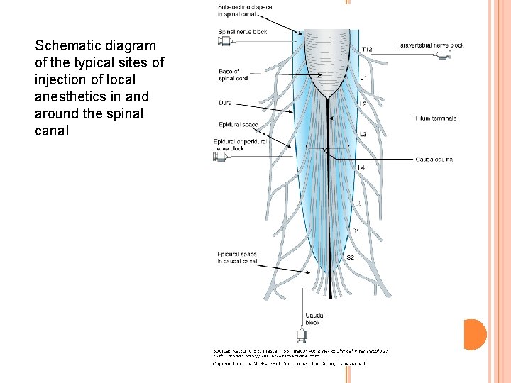 Schematic diagram of the typical sites of injection of local anesthetics in and around