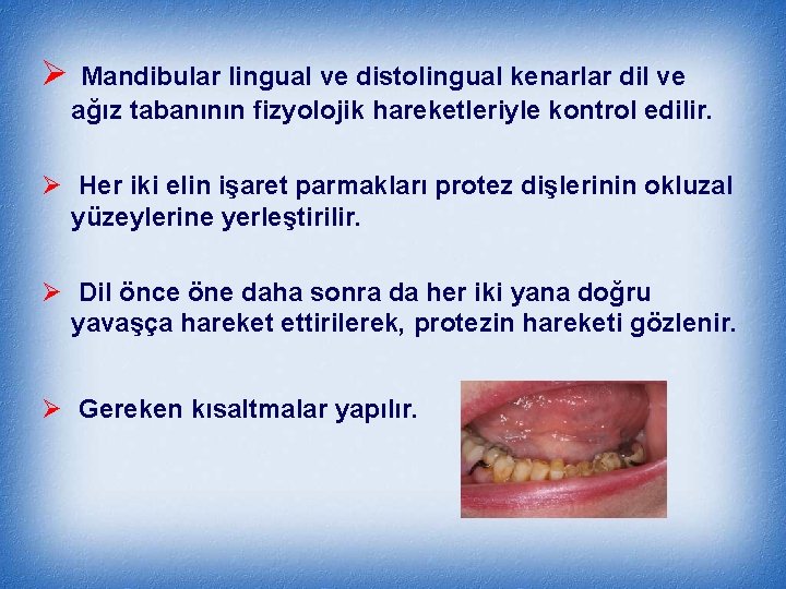 Ø Mandibular lingual ve distolingual kenarlar dil ve ağız tabanının fizyolojik hareketleriyle kontrol edilir.