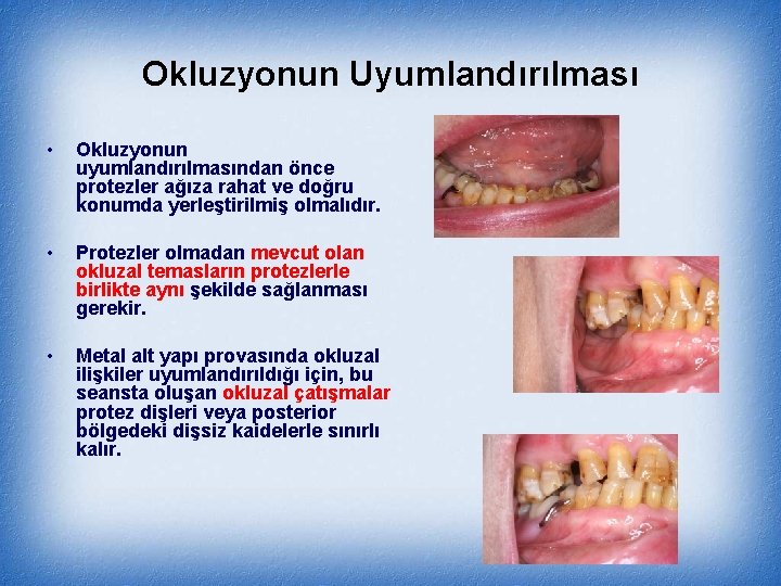 Okluzyonun Uyumlandırılması • Okluzyonun uyumlandırılmasından önce protezler ağıza rahat ve doğru konumda yerleştirilmiş olmalıdır.