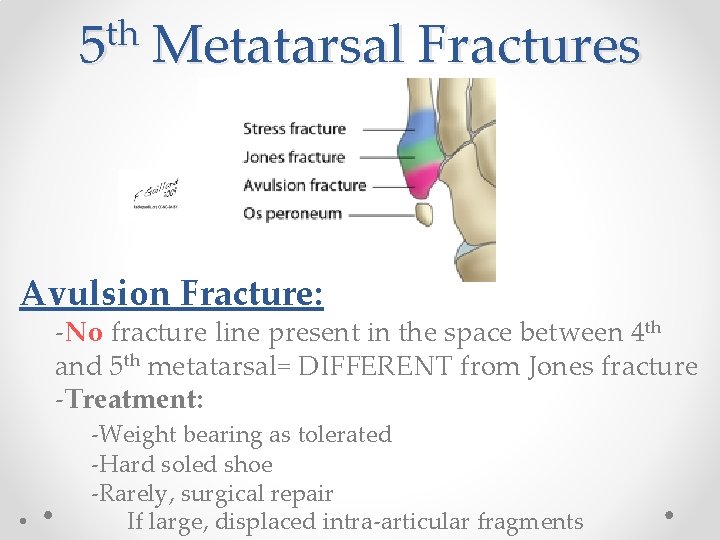 th 5 Metatarsal Fractures Avulsion Fracture: -No fracture line present in the space between