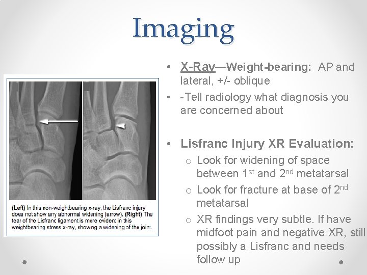 Imaging • X-Ray—Weight-bearing: AP and lateral, +/- oblique • -Tell radiology what diagnosis you