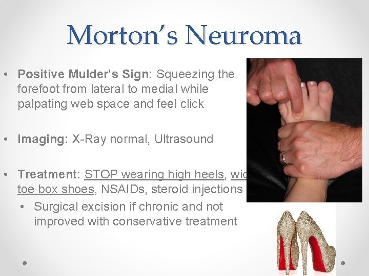 Morton’s Neuroma • Positive Mulder’s Sign: Squeezing the forefoot from lateral to medial while