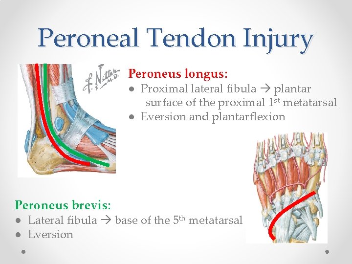 Peroneal Tendon Injury Peroneus longus: ● Proximal lateral fibula plantar surface of the proximal