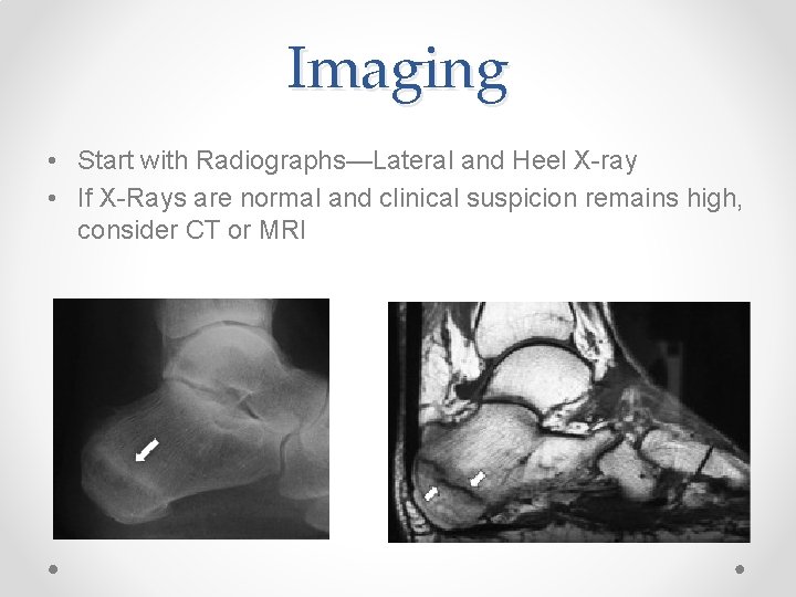 Imaging • Start with Radiographs—Lateral and Heel X-ray • If X-Rays are normal and