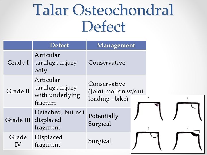 Talar Osteochondral Defect Management Articular Grade I cartilage injury only Conservative Articular cartilage injury