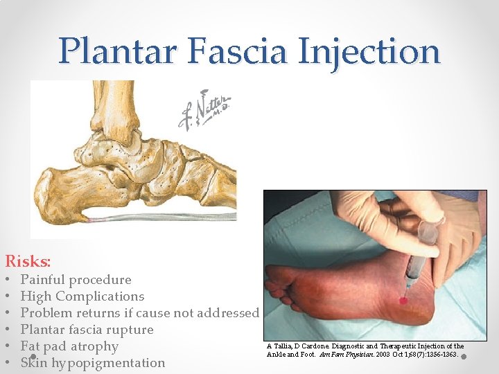 Plantar Fascia Injection Risks: • • • Painful procedure High Complications Problem returns if