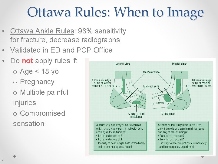 Ottawa Rules: When to Image • Ottawa Ankle Rules: 98% sensitivity for fracture, decrease