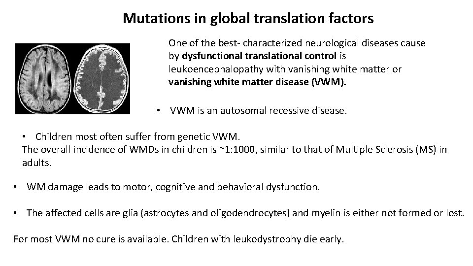Mutations in global translation factors One of the best- characterized neurological diseases cause by