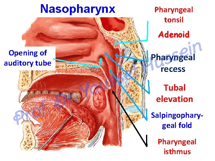 Nasopharynx Pharyngeal tonsil Adenoid Opening of auditory tube Pharyngeal recess Tubal elevation Salpingopharygeal fold