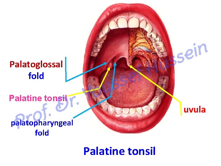 Palatoglossal fold Palatine tonsil uvula palatopharyngeal fold Palatine tonsil 
