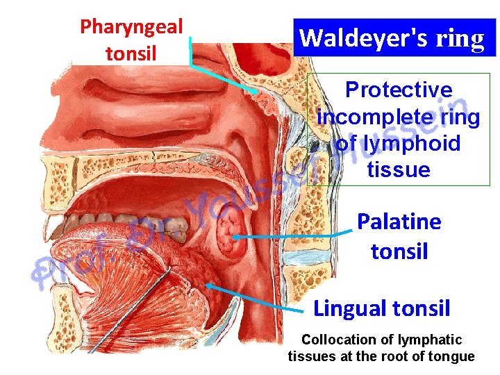 Pharyngeal tonsil Waldeyer's ring Protective incomplete ring of lymphoid tissue Palatine tonsil Lingual tonsil