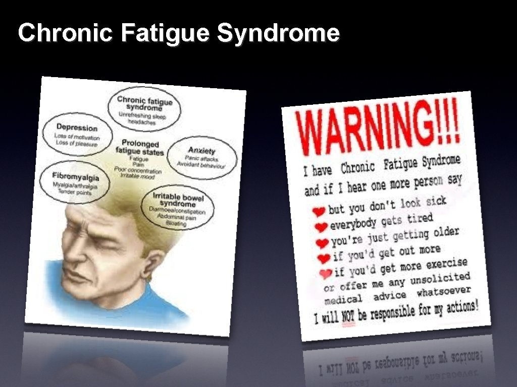 Chronic Fatigue Syndrome 