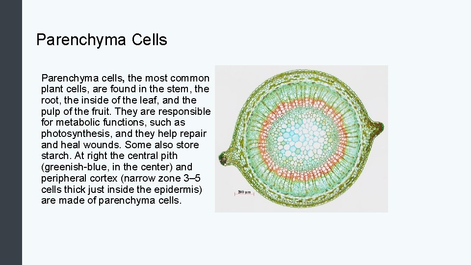 Parenchyma Cells Parenchyma cells, the most common plant cells, are found in the stem,