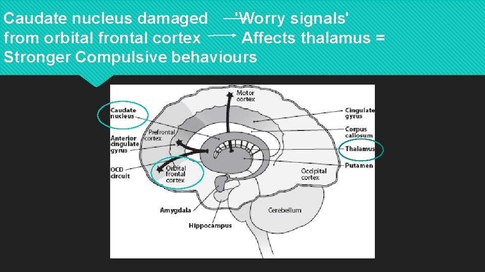 Caudate nucleus damaged 'Worry signals' from orbital frontal cortex Affects thalamus = Stronger Compulsive
