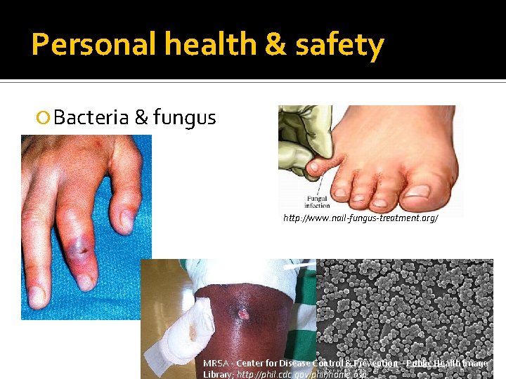 Personal health & safety Bacteria & fungus http: //www. nail-fungus-treatment. org/ MRSA - Center