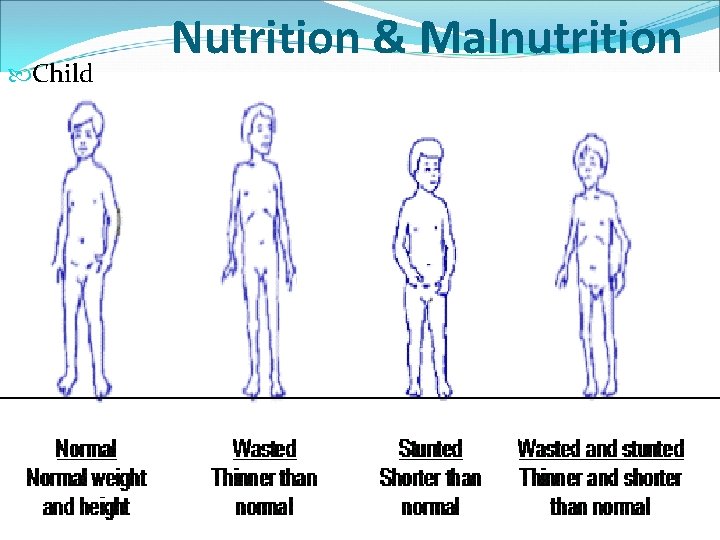  Child Nutrition & Malnutrition 