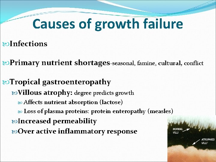 Causes of growth failure Infections Primary nutrient shortages-seasonal, famine, cultural, conflict Tropical gastroenteropathy Villous