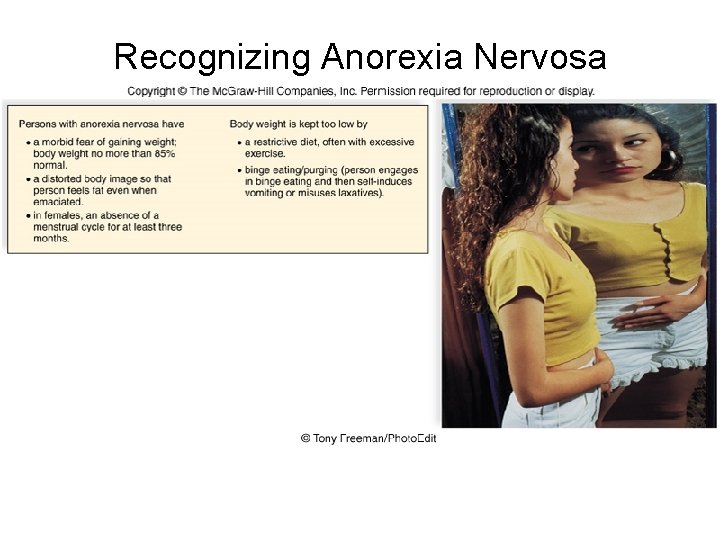Recognizing Anorexia Nervosa 