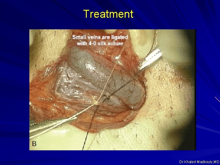 Treatment Dr. Khaled Madbouly, MD. Treatment Dr. Khaled Madbouly, MD.