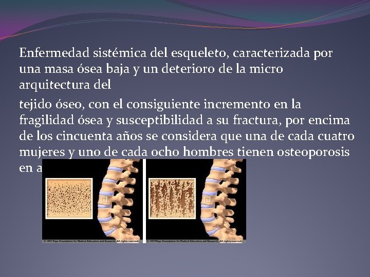 Enfermedad sistémica del esqueleto, caracterizada por una masa ósea baja y un deterioro de