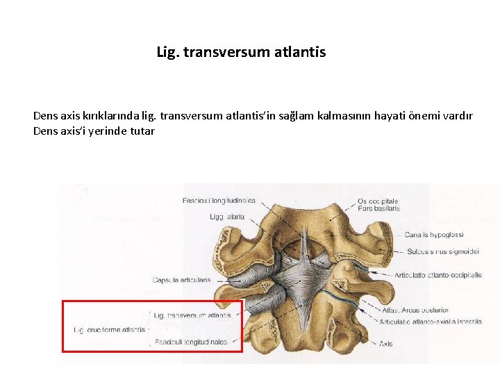 Lig. transversum atlantis Dens axis kırıklarında lig. transversum atlantis’in sağlam kalmasının hayati önemi vardır