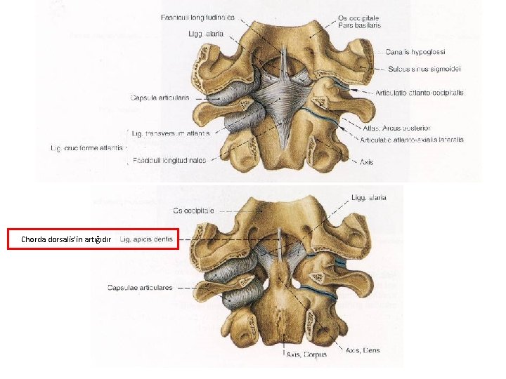 Chorda dorsalis’in artığıdır 