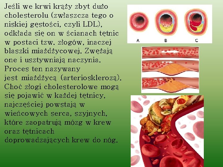 Jeśli we krwi krąży zbyt dużo cholesterolu (zwłaszcza tego o niskiej gęstości, czyli LDL),