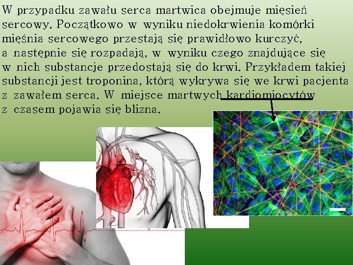 W przypadku zawału serca martwica obejmuje mięsień sercowy. Początkowo w wyniku niedokrwienia komórki mięśnia