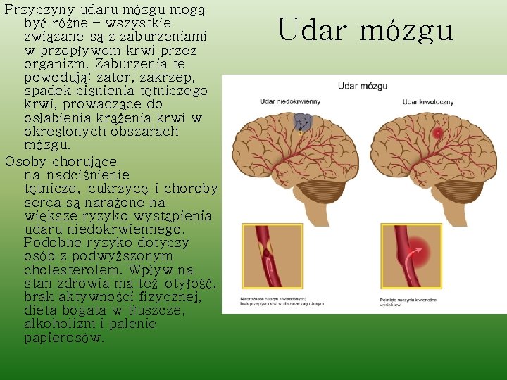 Przyczyny udaru mózgu mogą być różne – wszystkie związane są z zaburzeniami w przepływem