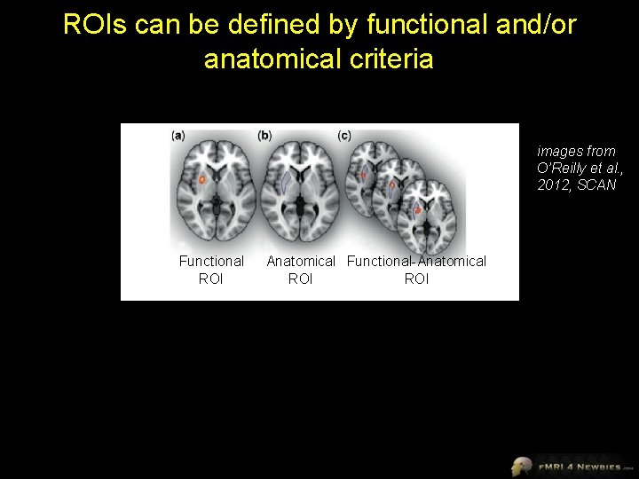 ROIs can be defined by functional and/or anatomical criteria images from O’Reilly et al.