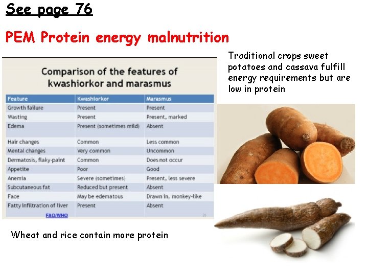 See page 76 PEM Protein energy malnutrition Traditional crops sweet potatoes and cassava fulfill