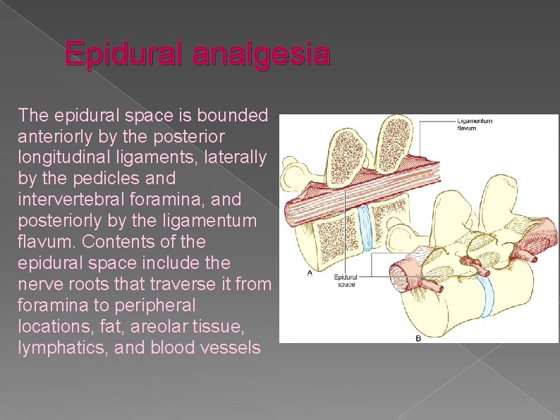 Epidural analgesia The epidural space is bounded anteriorly by the posterior longitudinal ligaments, laterally