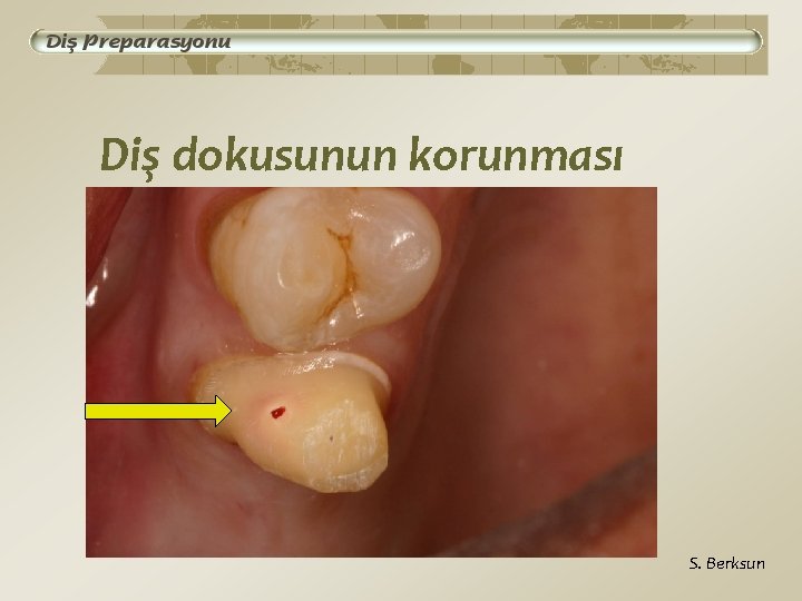 Diş dokusunun korunması S. Berksun 