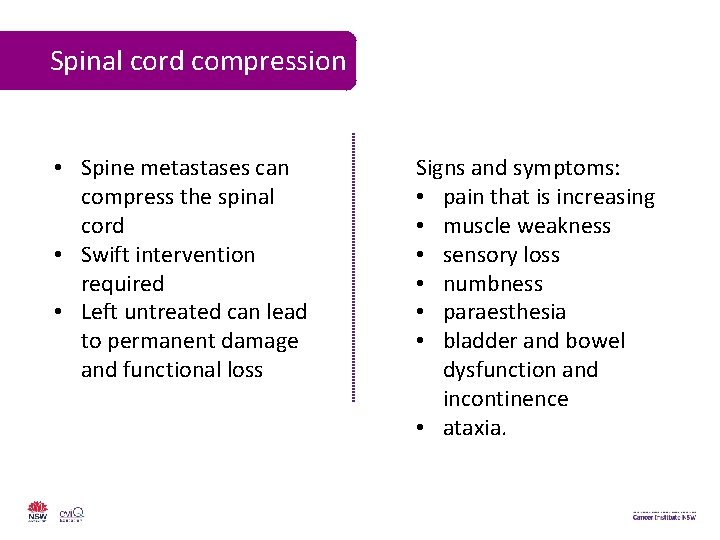 Spinal cord compression • Spine metastases can compress the spinal cord • Swift intervention