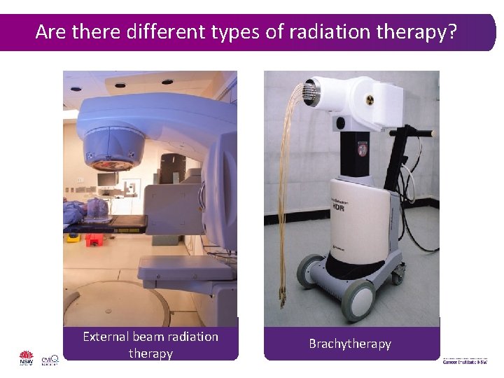 Are there different types of radiation therapy? External beam radiation therapy Brachytherapy 