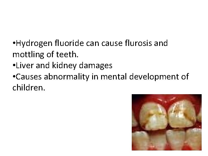  • Hydrogen fluoride can cause flurosis and mottling of teeth. • Liver and