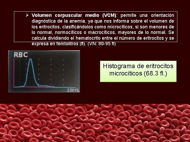 Ø Volumen corpuscular medio (VCM): permite una orientación diagnóstica de la anemia, ya que