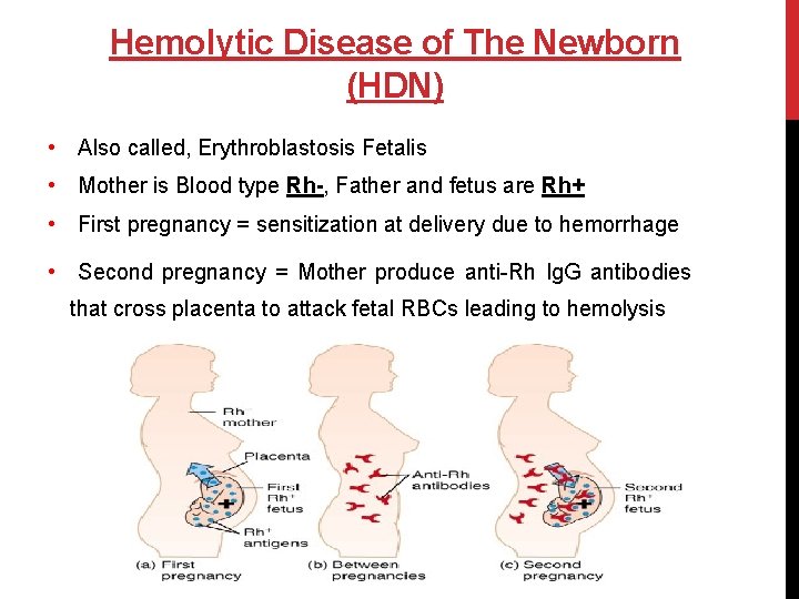 Hemolytic Disease of The Newborn (HDN) • Also called, Erythroblastosis Fetalis • Mother is