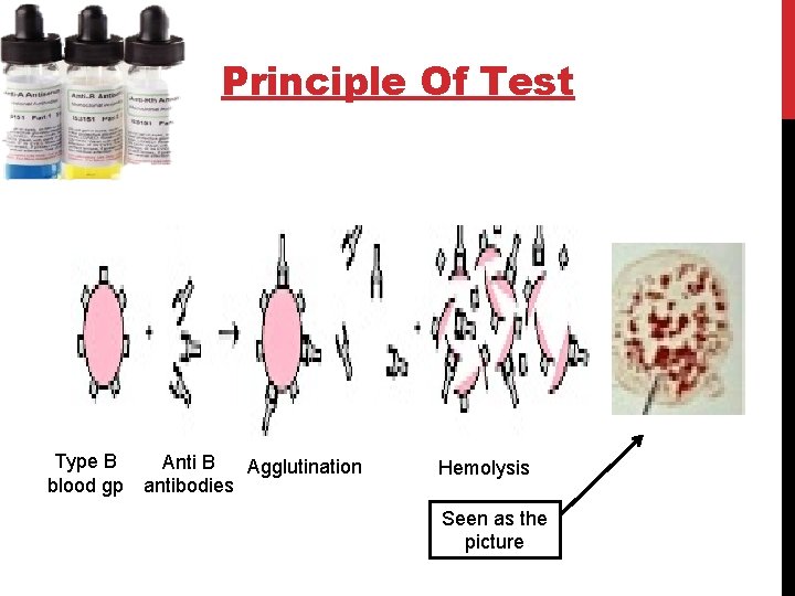 Principle Of Test Type B blood gp Anti B Agglutination antibodies Hemolysis Seen as