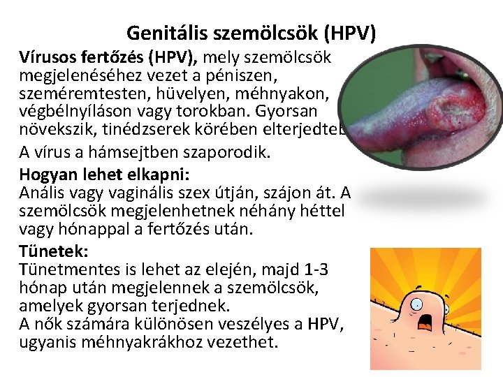 Genitális szemölcsök (HPV) Vírusos fertőzés (HPV), mely szemölcsök megjelenéséhez vezet a péniszen, szeméremtesten, hüvelyen,