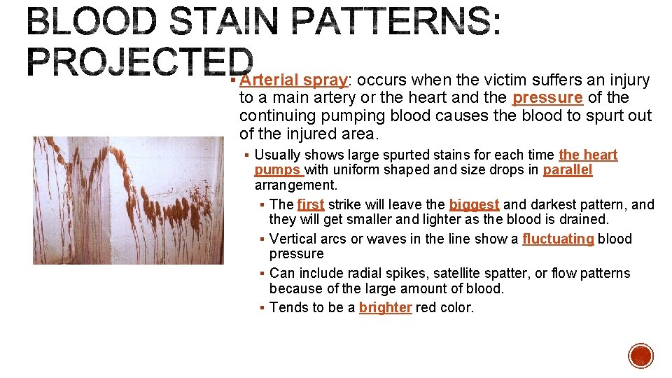 § Arterial spray: occurs when the victim suffers an injury to a main artery