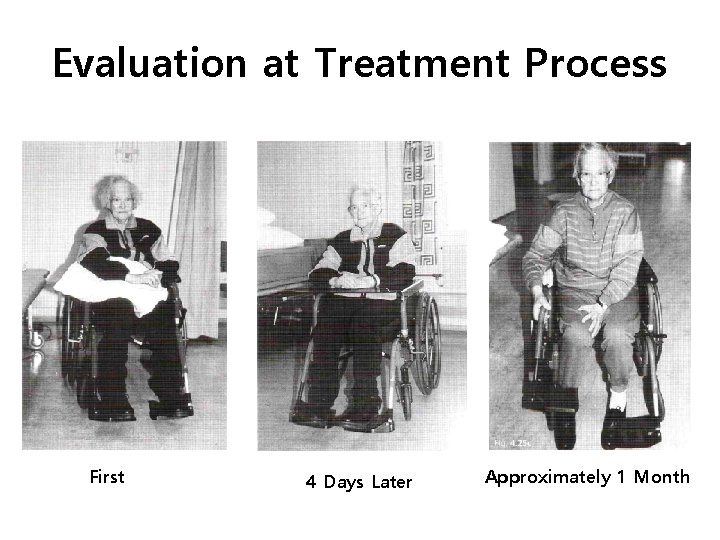 Evaluation at Treatment Process First 4 Days Later Approximately 1 Month 