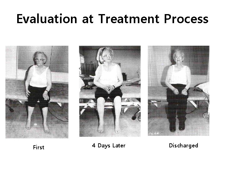 Evaluation at Treatment Process First 4 Days Later Discharged 