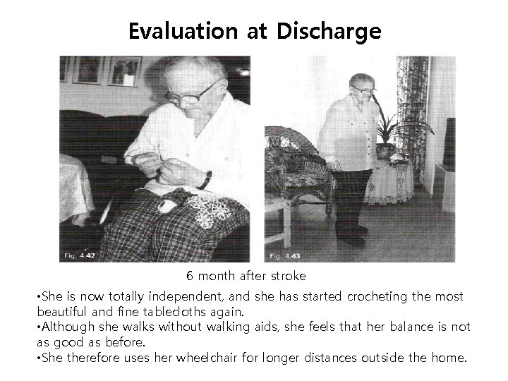 Evaluation at Discharge 6 month after stroke • She is now totally independent, and