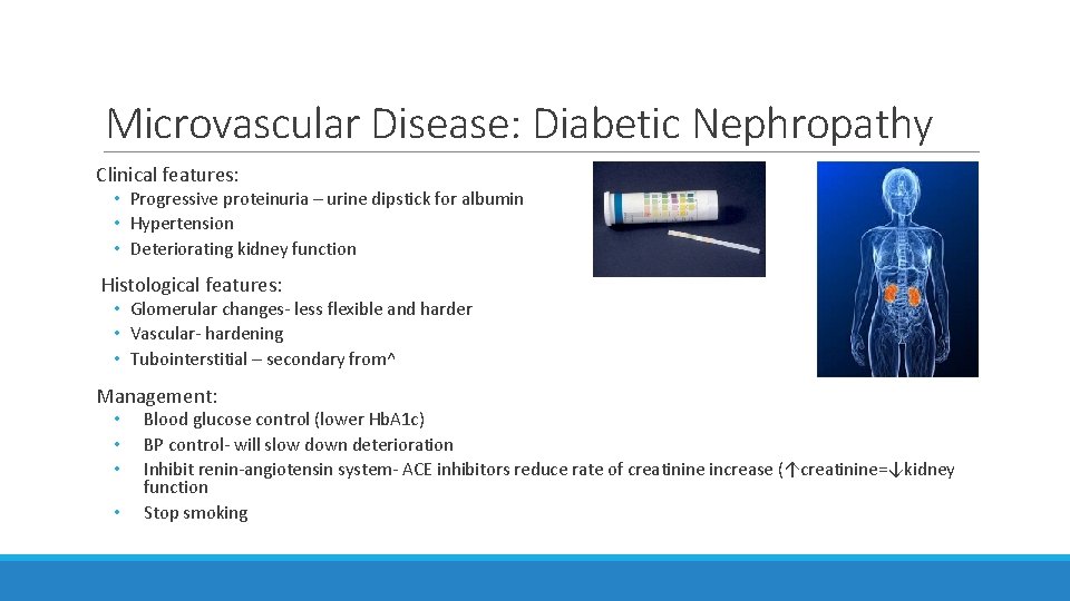 Microvascular Disease: Diabetic Nephropathy Clinical features: • Progressive proteinuria – urine dipstick for albumin