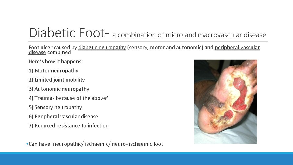 Diabetic Foot- a combination of micro and macrovascular disease Foot ulcer caused by diabetic