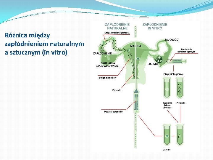 Różnica między zapłodnieniem naturalnym a sztucznym (in vitro) 