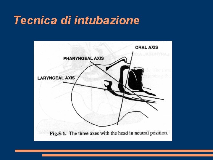 Tecnica di intubazione 