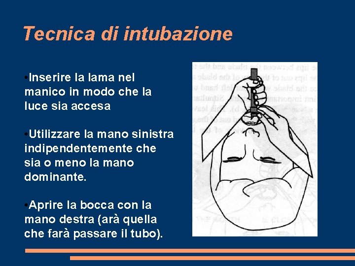 Tecnica di intubazione • Inserire la lama nel manico in modo che la luce